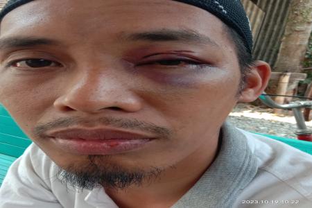 KARNA CEMBURU BUTA USTAD DI KUTAWI